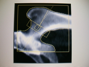 hologic_2.jpg hologic_2.jpg